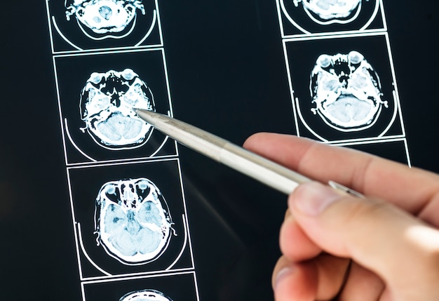 Teen with Rare Memory Superpower: Inside a High Schooler's Hyperthymesia