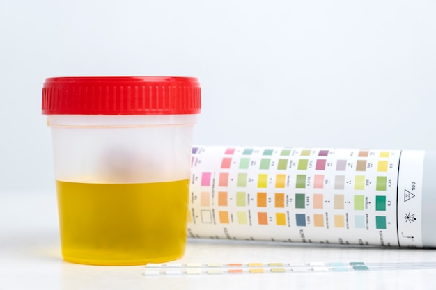 Urine color hydration guide